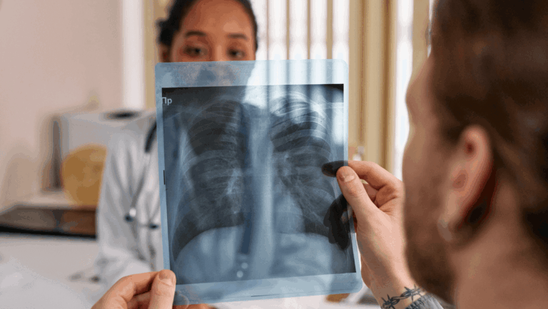 Síntomas cáncer de pulmón (1)